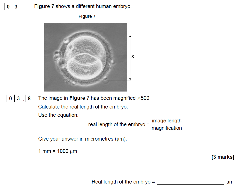 Aqa Gcse June Foundation Biology Past Paper Questions And